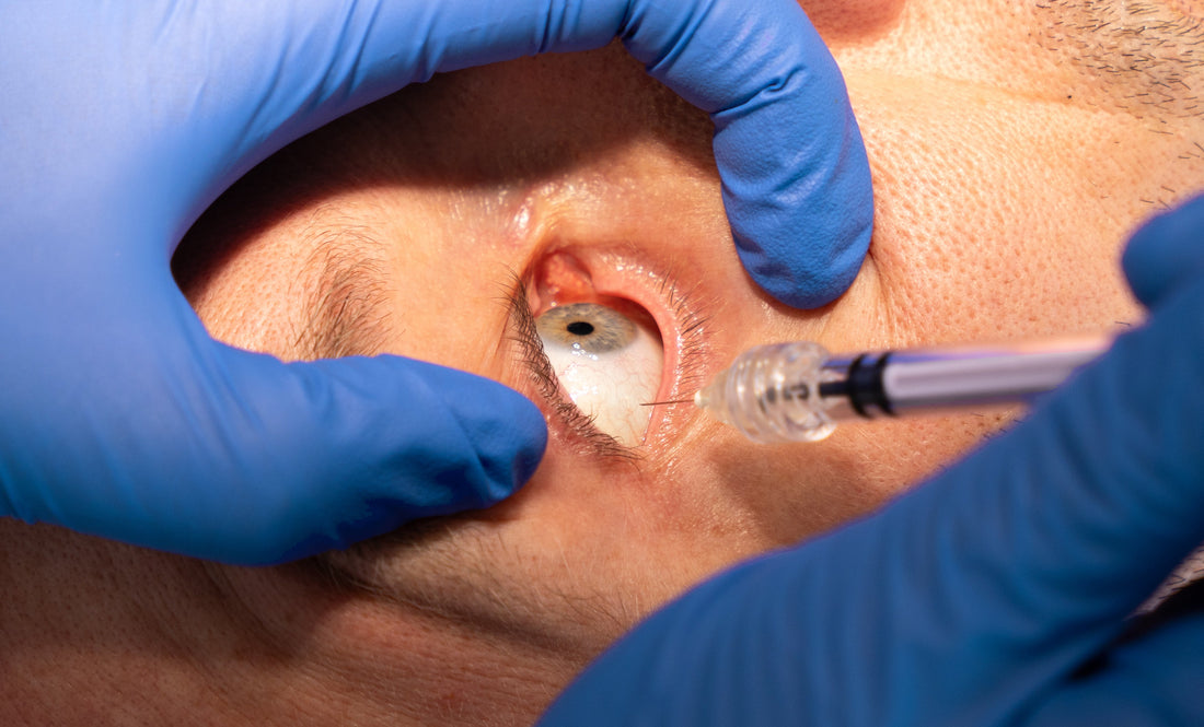 TSK Laboratory Canada: Premium Needle Solutions – TSK Laboratory ...